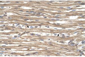Human Muscle (ACTR2 antibody  (N-Term))