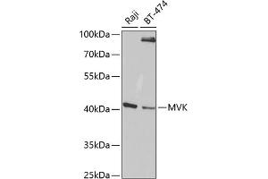 Western blot analysis of extracts of various cell lines, using MVK antibody (ABIN6128256, ABIN6144204, ABIN6144205 and ABIN6220991) at 1:1000 dilution. (MVK antibody  (AA 40-300))