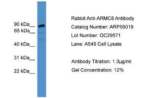 WB Suggested Anti-ARMC8  Antibody Titration: 0. (ARMC8 antibody  (N-Term))