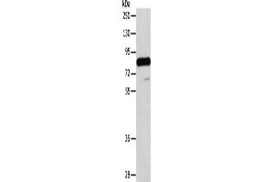 Gel: 8 % SDS-PAGE, Lysate: 40 μg, Lane: Human testis tissue, Primary antibody: ABIN7128234(ADAM32 Antibody) at dilution 1/100, Secondary antibody: Goat anti rabbit IgG at 1/8000 dilution, Exposure time: 10 minutes (ADAM32 antibody)