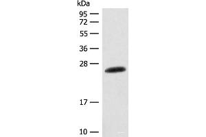 Western blot analysis of Mouse skin tissue lysate using CSNK2B Polyclonal Antibody at dilution of 1:400 (CSNK2B antibody)