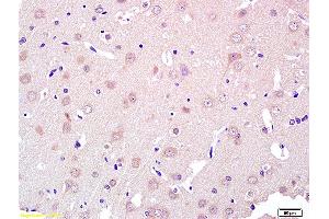 Formalin-fixed and paraffin embedded rat brain labeled with Rabbit Anti ROR1/ROR alpha Polyclonal Antibody, Unconjugated (ABIN1387717) at 1:200 followed by conjugation to the secondary antibody and DAB staining (ROR1 antibody  (AA 301-360))