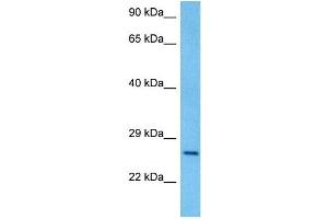 Host:  Rat  Target Name:  PAX4  Sample Tissue:  Rat Brain  Antibody Dilution:  1ug/ml (PAX4 antibody  (Middle Region))