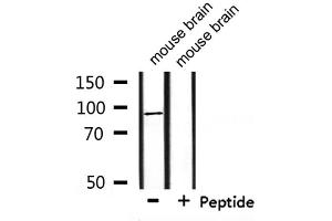 Western blot analysis of extracts from mouse brain, using HCN2 Antibody. (HCN2 antibody  (Internal Region))