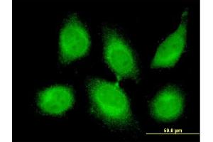 Immunofluorescence of monoclonal antibody to CBLL1 on HeLa cell.