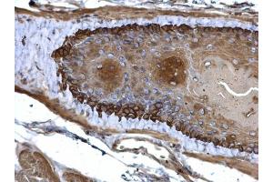 IHC-P Image Cytokeratin 13 antibody detects Cytokeratin 13 protein at cytosol on mouse esophagus by immunohistochemical analysis.