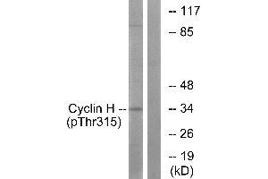 Western blot analysis of extracts from HeLa cells, using Cyclin H (Phospho-Thr315) antibody. (Cyclin H antibody  (pThr315))