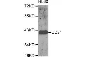 Western blot analysis of extracts of HL60 cell, using CD34 antibody. (CD34 antibody  (AA 32-290))