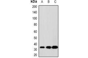 Western blot analysis of SCP3 expression in K562 (A), 22RV1 (B), H480 (C) whole cell lysates. (SYCP3 antibody)