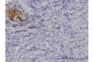 Image no. 1 for anti-Angiopoietin-Like 1 (ANGPTL1) (AA 24-492) antibody (ABIN598593) (ANGPTL1 antibody  (AA 24-492))