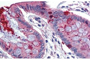 Immunohistochemistry with Human Colon lysate tissue at an antibody concentration of 5.