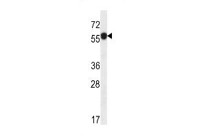 Western blot analysis in ZR-75-1 cell line lysates (35ug/lane). (C6ORF211 antibody  (N-Term))