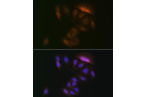 Immunofluorescence analysis of U-2 OS cells using MEK3 Rabbit mAb (ABIN1682965, ABIN3017630, ABIN3017631 and ABIN7101512) at dilution of 1:100 (40x lens). (MAP2K3 antibody)