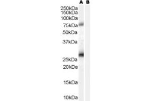 Image no. 1 for anti-Estrogen Receptor Binding Site Associated, Antigen, 9 (EBAG9) (C-Term) antibody (ABIN374701) (RCAS1 antibody  (C-Term))