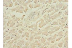Immunohistochemistry of paraffin-embedded human heart tissue using ABIN7163880 at dilution of 1:100 (GALNT2 antibody  (AA 442-571))
