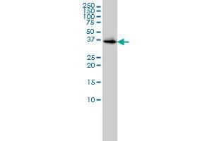 BLVRA monoclonal antibody (M01), clone 4G4-2B6 Western Blot analysis of BLVRA expression in 293 . (Biliverdin Reductase antibody  (AA 1-296))