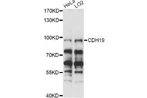 Western blot analysis of extracts of various cell lines, using CDH19 antibody (ABIN6291652) at 1:1000 dilution.
