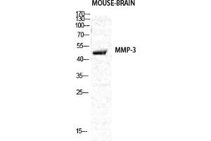 Western Blot analysis of various cells using MMP-3 Polyclonal Antibody diluted at 1:2000. (MMP3 antibody  (AA 390-470))