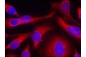Image no. 1 for anti-Protein Kinase D1 (PRKD1) (pSer738) antibody (ABIN196754) (PKC mu antibody  (pSer738))