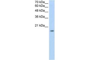 Western Blotting (WB) image for anti-Zinc Finger Protein 580 (ZNF580) antibody (ABIN2461874)