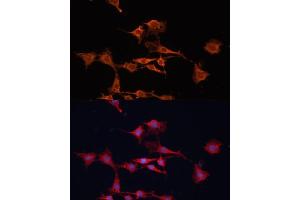 Immunofluorescence analysis of C6 cells using GSTM3 antibody (ABIN6131967, ABIN6141470, ABIN6141471 and ABIN6223605) at dilution of 1:100. (GSTM3 antibody  (AA 101-225))