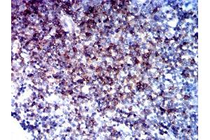 Immunohistochemical analysis of paraffin-embedded tonsil tissues using CD5 mouse mAb with DAB staining. (CD5 antibody  (AA 403-495))