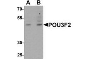Western blot analysis of POU3F2 in 3T3 cell lysate with POU3F2 antibody at (A) 1 and (B) 2 μg/mL. (POU3F2 antibody  (C-Term))