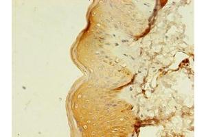 Immunohistochemistry of paraffin-embedded human skin tissue using ABIN7159241 at dilution of 1:100 (MLANA antibody  (AA 1-118))