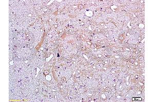 Formalin-fixed and paraffin embedded rat brain tissue labeled with Anti-IL-18 Polyclonal Antibody (ABIN669696), Unconjugated at 1:200, followed by conjugation to the secondary antibody and DAB staining (IL-18 antibody)