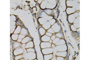 Immunohistochemistry of paraffin-embedded Human colon using AZGP1 Polyclonal Antibody at dilution of 1:100 (40x lens). (AZGP1 antibody)