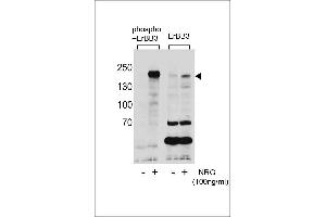 Western blot analysis of extracts from T47D cells,untreated or treated with NRG using Phospho-ErBB3(Tyr1289)(left) or ErBB3 Antibody (right). (ERBB3 antibody  (pTyr1289))