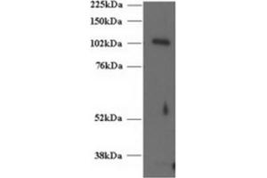 Image no. 1 for anti-Unc-13 Homolog D (UNC13D) (C-Term) antibody (ABIN374437) (UNC13D antibody  (C-Term))