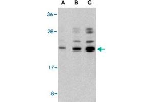 Western blot analysis of CASP6 in Jurkat cell lysate with CASP6 polyclonal antibody  at (A) 0. (Caspase 6 antibody  (N-Term))