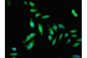Immunofluorescent analysis of Hela cells using ABIN7153665 at dilution of 1:100 and Alexa Fluor 488-congugated AffiniPure Goat Anti-Rabbit IgG(H+L) (Non-Syndromic Hearing Impairment Protein 5 (GSDME) (AA 1-496) antibody)