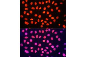 Immunofluorescence analysis of HeLa cells using TriMethyl-Histone H3-K64 antibody (ABIN7267701) at dilution of 1:100. (Histone 3 antibody  (H3K64me3))