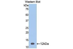 Western Blotting (WB) image for anti-serpin Peptidase Inhibitor, Clade A (Alpha-1 Antiproteinase, Antitrypsin), Member 12 (SERPINA12) (AA 52-143) antibody (ABIN3208031) (SERPINA12 antibody  (AA 52-143))