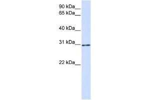 AKT1S1 antibody used at 1 ug/ml to detect target protein.