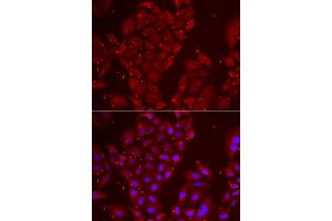 Immunofluorescence analysis of U2OS cells using TPP2 antibody (ABIN5973821). (Tpp2 antibody)