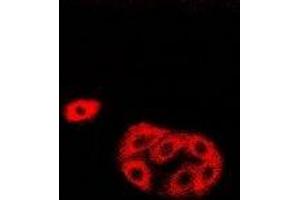 Immunofluorescent analysis of HAPLN1 staining in Hela cells. (HAPLN1 antibody)