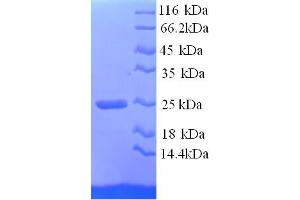 SDS-PAGE (SDS) image for Collagen, Type I, alpha 1 (COL1A1) (AA 955-1207), (partial) protein (His tag) (ABIN5713374)