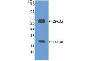 Detection of Recombinant SIRT3, Mouse using Polyclonal Antibody to Sirtuin 3 (SIRT3) (SIRT3 antibody  (AA 5-257))