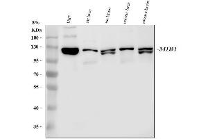 Western blot analysis of Mib1 using anti-Mib1 antibody (ABIN6719398).