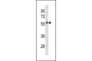 Mouse Plau Antibody (C-term) (ABIN1881658 and ABIN2843214) western blot analysis in human placenta tissue lysates (35 μg/lane). (PLAU antibody  (C-Term))