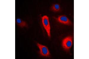 Immunofluorescent analysis of Cytokeratin 16 staining in HeLa cells. (KRT16 antibody  (C-Term))