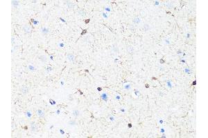 Immunohistochemistry of paraffin-embedded rat brain using TH Antibody (ABIN5974878) at dilution of 1/100 (40x lens). (TH antibody)