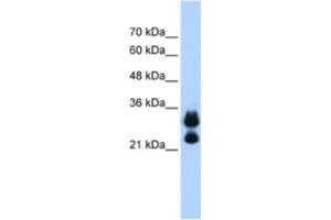 Western Blotting (WB) image for anti-Histone Cluster 1, H1c (HIST1H1C) antibody (ABIN2462944)