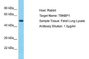 Host: Rabbit Target Name: TBKBP1 Sample Type: Fetal Lung lysates Antibody Dilution: 1.