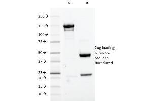 SDS-PAGE Analysis Purified Cdk1 Mouse Monoclonal Antibody (A17. (CDK1 antibody  (C-Term))