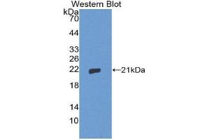 Western Blotting (WB) image for anti-Thimet Oligopeptidase 1 (THOP1) (AA 451-597) antibody (ABIN1871528) (Thimet Oligopeptidase 1 antibody  (AA 451-597))