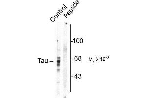 Image no. 1 for anti-Microtubule-Associated Protein tau (MAPT) (pSer416) antibody (ABIN372727)